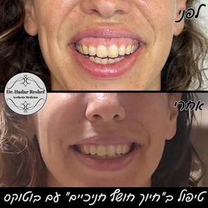 אסתטיקת פנים | ד"ר הדר רשף
