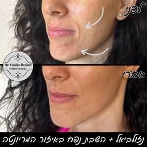 אסתטיקת פנים | ד"ר הדר רשף
