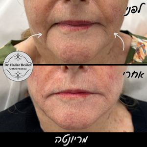 אסתטיקת פנים | ד"ר הדר רשף