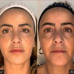 אסתטיקת פנים | כץ קליניק katz clinic