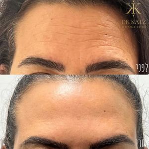 אסתטיקת פנים | כץ קליניק katz clinic
