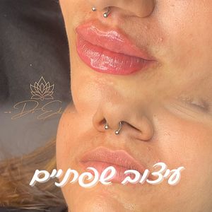 אסתטיקת פנים | ד״ר עדן דוידוב
