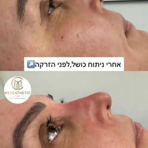 אסתטיקת פנים | ד״ר חאלד מוחמד
