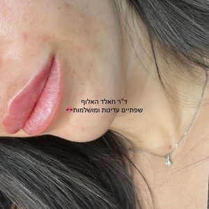 אסתטיקת פנים | ד״ר חאלד מוחמד