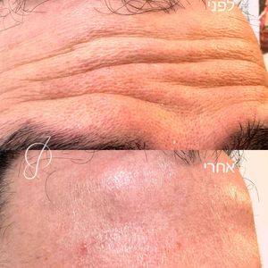 כירורגית כלי דם | ד"ר אוסאמה ג׳רוס