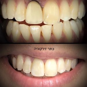 רפואת שיניים - שיקום הפה - מומחה | ד"ר דנה אמיר-קליין