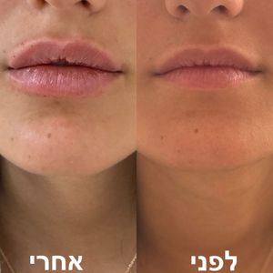 אסתטיקת פנים | ד"ר חמאתי ח'ליל