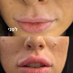 אסתטיקת פנים | ד"ר חמאתי ח'ליל
