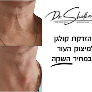 רפואה אסתטית | ד"ר יקטרינה שלקוב