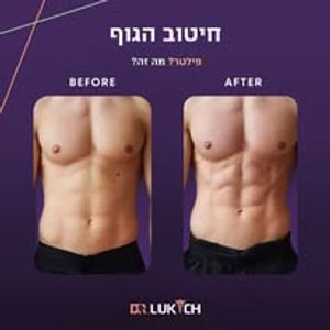 רפואה אסתטית | ד"ר אלה לוקיץ