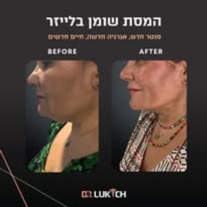 רפואה אסתטית | ד"ר אלה לוקיץ