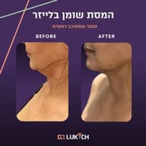 רפואה אסתטית | ד"ר אלה לוקיץ