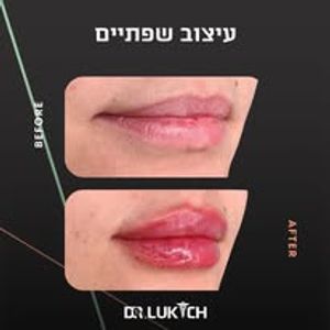 רפואה אסתטית | ד"ר אלה לוקיץ
