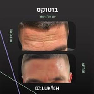 רפואה אסתטית | ד"ר אלה לוקיץ