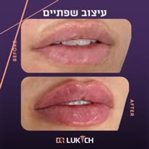 רפואה אסתטית | ד"ר אלה לוקיץ