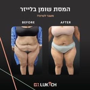 רפואה אסתטית | ד"ר אלה לוקיץ