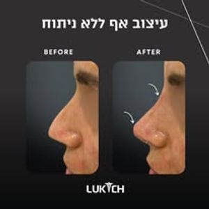 רפואה אסתטית | ד"ר אלה לוקיץ
