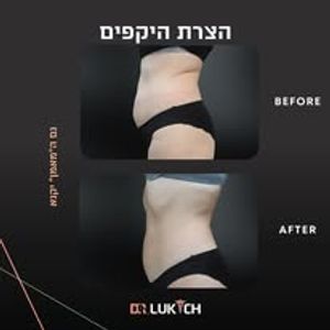 רפואה אסתטית | ד"ר אלה לוקיץ