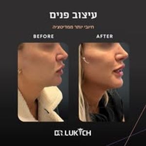 רפואה אסתטית | ד"ר אלה לוקיץ