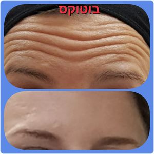 רפואה אסתטית | ד"ר פטריסיה שבס