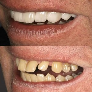 רפואת שיניים | Smile Care - ד״ר מג'ד אבו רקיה