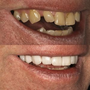 רפואת שיניים | Smile Care - ד״ר מג'ד אבו רקיה