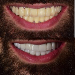 רפואת שיניים | Smile Care - ד״ר מג'ד אבו רקיה