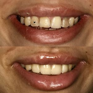 רפואת שיניים | Smile Care - ד״ר מג'ד אבו רקיה