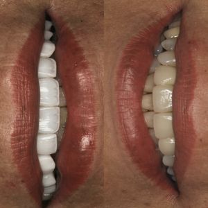 רפואת שיניים | Smile Care - ד״ר מג'ד אבו רקיה