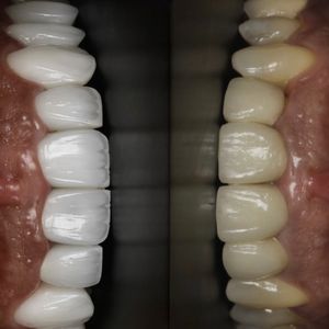רפואת שיניים | Smile Care - ד״ר מג'ד אבו רקיה