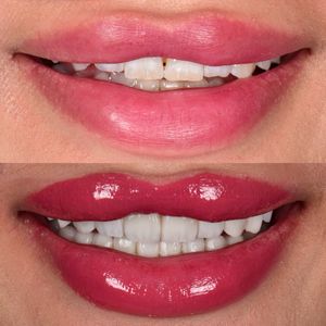 רפואת שיניים | Smile Care - ד״ר מג'ד אבו רקיה