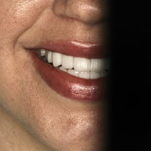 רפואת שיניים | Smile Care - ד״ר מג'ד אבו רקיה