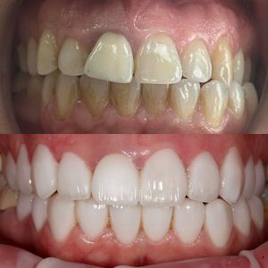 רפואת שיניים | Smile Care - ד״ר מג'ד אבו רקיה