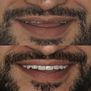 רפואת שיניים | Smile Care - ד״ר מג'ד אבו רקיה