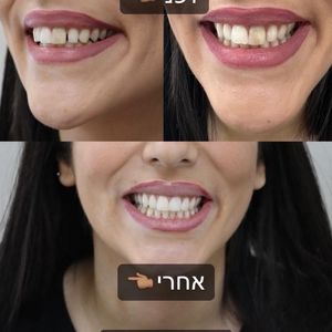 רפואת שיניים | Smile Care - ד״ר מג'ד אבו רקיה