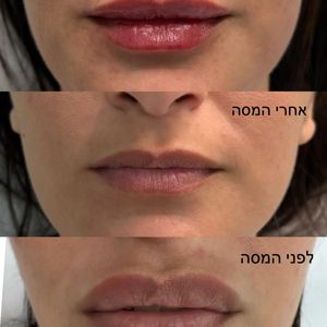 אסתטיקת פנים | ד"ר שי תלם