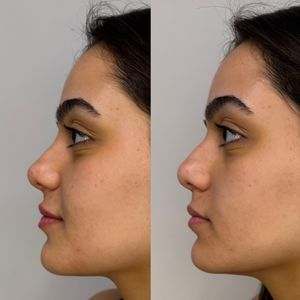 אסתטיקת פנים | ד"ר שי תלם