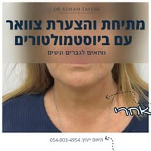 רפואה אסתטית | ד"ר טאפש אדהם Dr. Adham Tafesh