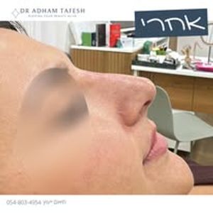 רפואה אסתטית | ד"ר טאפש אדהם Dr. Adham Tafesh