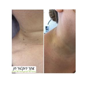 רפואה אסתטית | ד"ר לאוניד קאן - מרכזי דוקטור חן