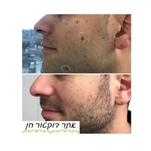 רפואה אסתטית | ד"ר לאוניד קאן - מרכזי דוקטור חן
