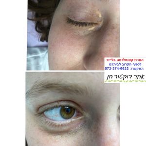 רפואה אסתטית | ד"ר לאוניד קאן - מרכזי דוקטור חן