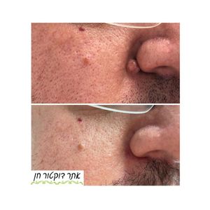 רפואה אסתטית | ד"ר לאוניד קאן - מרכזי דוקטור חן