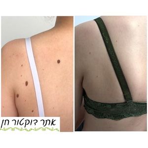 רפואה אסתטית | ד"ר לאוניד קאן - מרכזי דוקטור חן