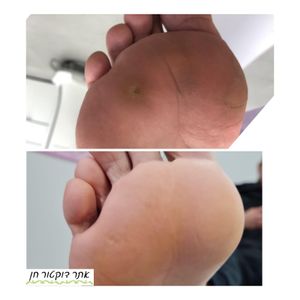 רפואה אסתטית | ד"ר לאוניד קאן - מרכזי דוקטור חן