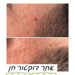 רפואה אסתטית | ד"ר לאוניד קאן - מרכזי דוקטור חן
