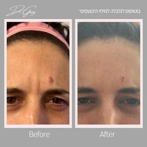 רפואה אסתטית | ד"ר גרי גלי בריסקין