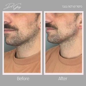 רפואה אסתטית | ד"ר גרי גלי בריסקין
