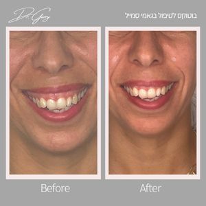 רפואה אסתטית | ד"ר גרי גלי בריסקין