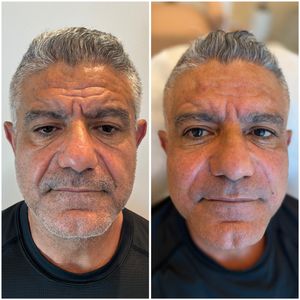 רפואה אסתטית | ד"ר מחמוד בדארנה